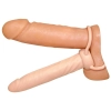  Artikelbild 3 des Artikels “Anal Special nature “