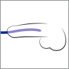  Artikelbild 3 des Artikels “Silikon Dilator 3er Set “