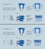  Artikelbild 4 des Artikels “Autoblow 2+XT C “
