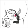  Artikelbild 7 des Artikels “Rebel Prostate Plug recharge “