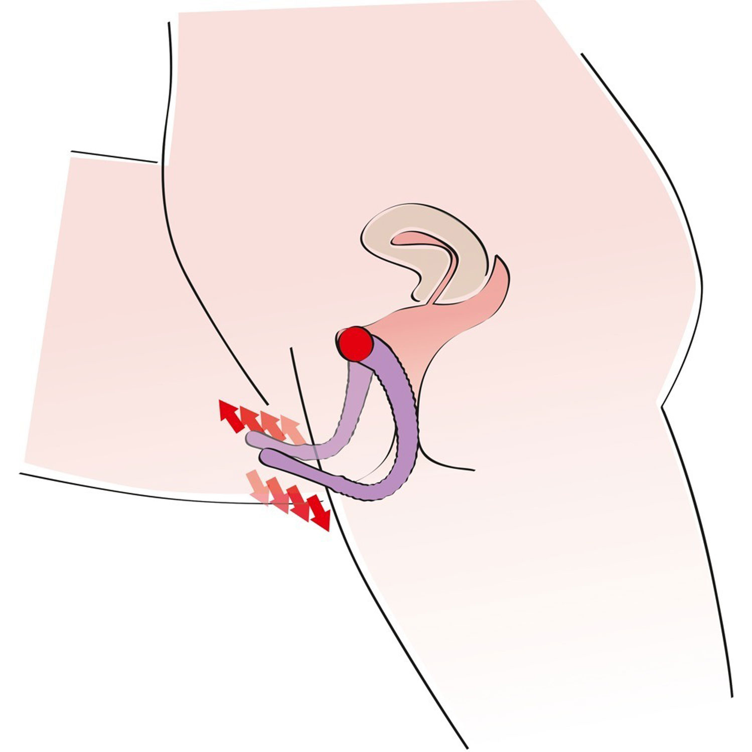  Artikelbild 4 des Artikels “Intimate Spreader Lila “