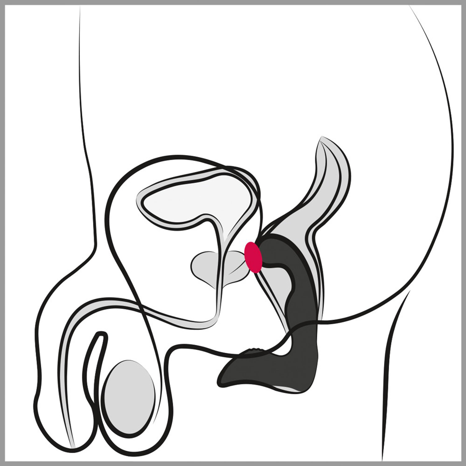  Artikelbild 7 des Artikels “Rebel Prostate Plug recharge “
